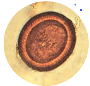 <ul><li><p><span>30 x 45 um</span></p></li><li><p><span>Thick, smooth striated shell</span></p></li><li><p><span><u>Oncosphere has 6 hooks</u></span></p><ul><li><p><span>May not always be visible</span></p></li><li><p><span>Immature larvae</span></p></li></ul></li><li><p><span><u>Must find adults to speciate</u></span></p></li></ul><p></p>