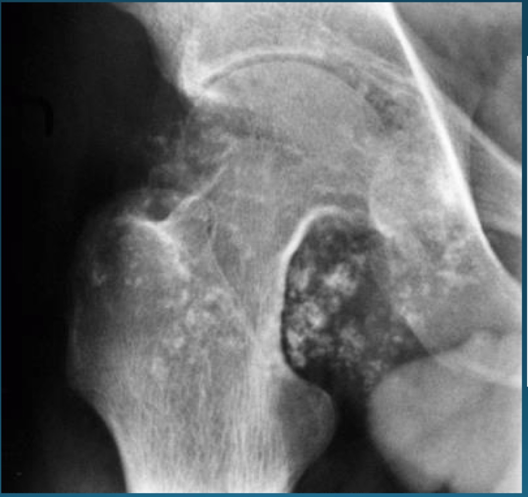 <p>what do you call this feature? what diagnosis is this part of ?</p>