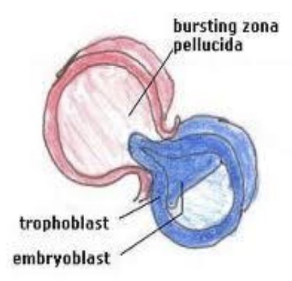<p>When<span style="color: purple;"> <strong>blastocyst escape</strong></span><strong> </strong>from <span style="color: purple;"><strong>zona pellucida </strong></span></p>