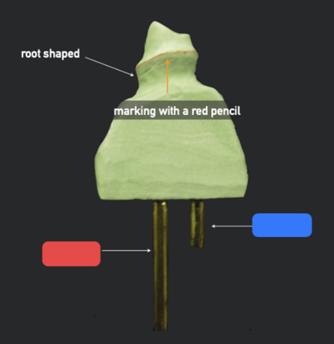 <p>What side of the tooth is indicated by the pin at the blue box?</p>