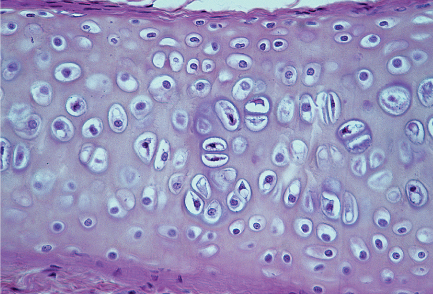 <p><span style="font-family: Calibri">Eases joint movement, holds airway open, moves vocal cords, growth of juvenile long bone; clear, glassy appearance; found in </span><span style="font-family: Calibri">articular cartilage, costal cartilage, trachea, larynx, fetal skeleton</span></p>