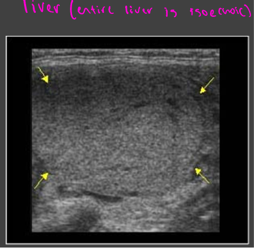 <p>Uniform in color</p><p>Liver</p>