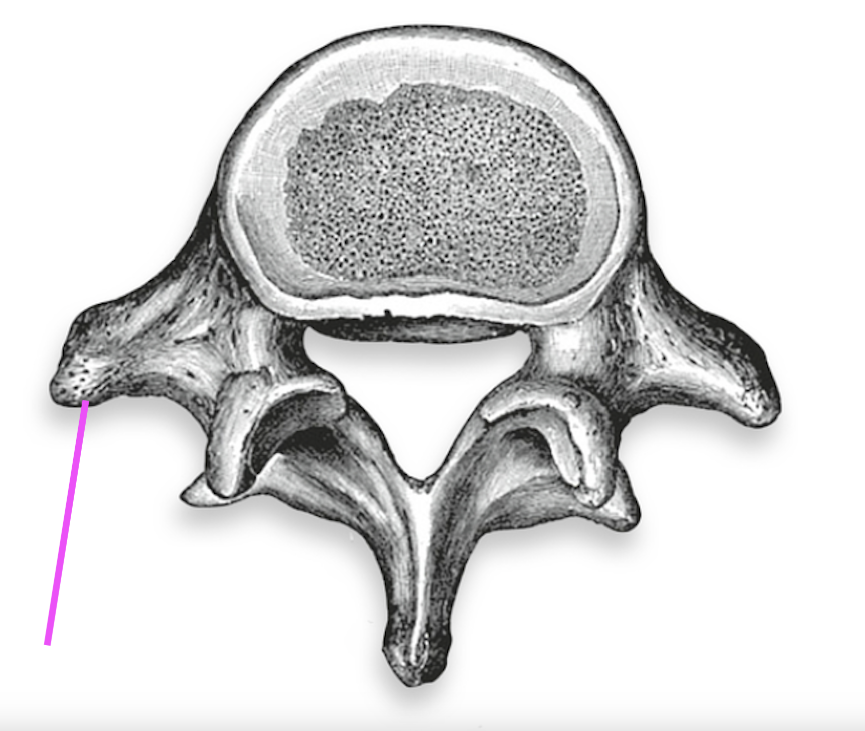 <p>What part of the vertebrae is this?</p>