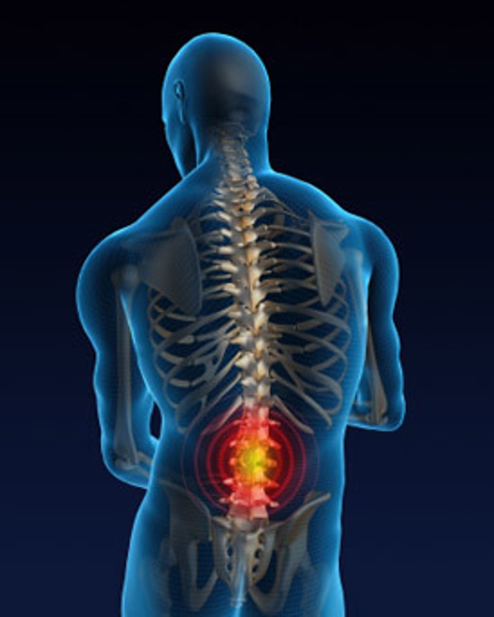 <p>pain extends past typical period of healing<br>- affects 1/3 of Americans<br>- major impact on daily life<br>- patients are severely undertreated</p>
