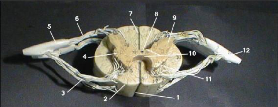 <ul><li><p>inner H-shaped core of gray matter: cell bodies and unmyelinated axons</p></li><li><p>surrounding area of white matter: myelinated axons</p></li></ul><p></p>