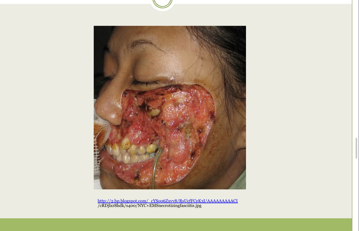What infection is this?