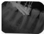 <p>Which background colour would make this radiograph more discernible? white or black?</p>