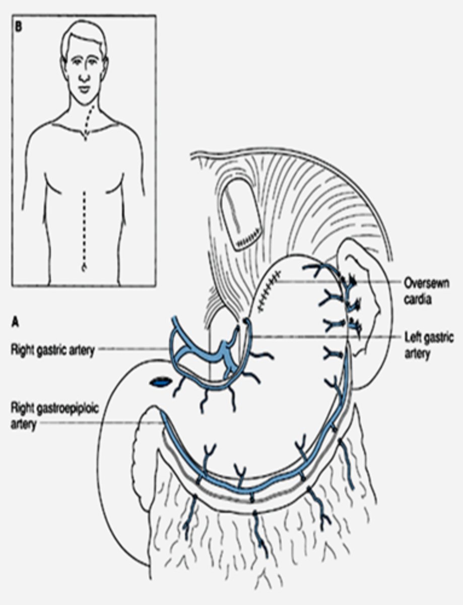 <p>abdomen, neck</p>