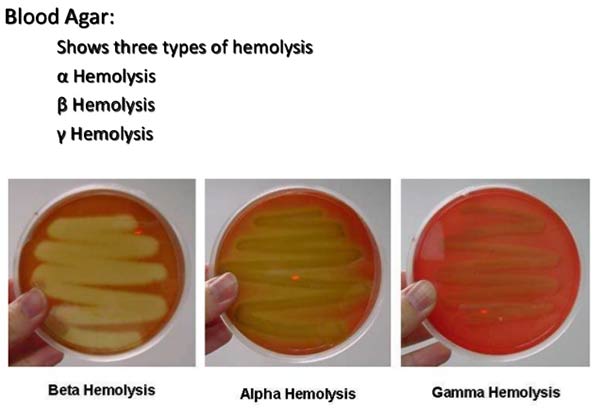 <p>It forms a transparent hemolytic zone on blood agar plates because its antigens lyse red blood cells</p>