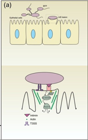 <p>It <strong>disrupts the cytoskeleton</strong>, forming <strong>pedestal-like lesions</strong>, leading to <strong>cell destruction and reduced absorption</strong>.</p>