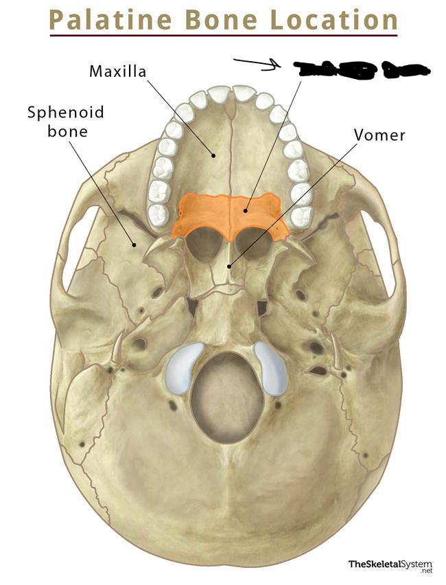 <p>Which part of the hard palate is this?</p>