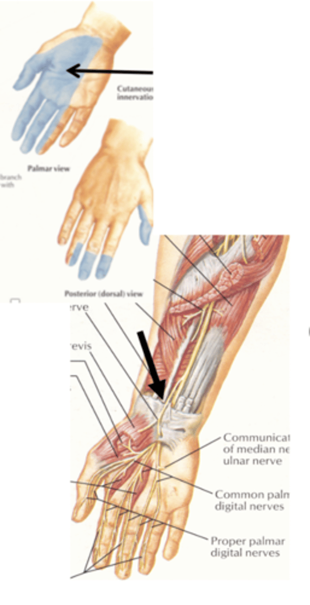 <p>palmar</p><p>anterior</p><p>the skin of the lateral palm.</p>