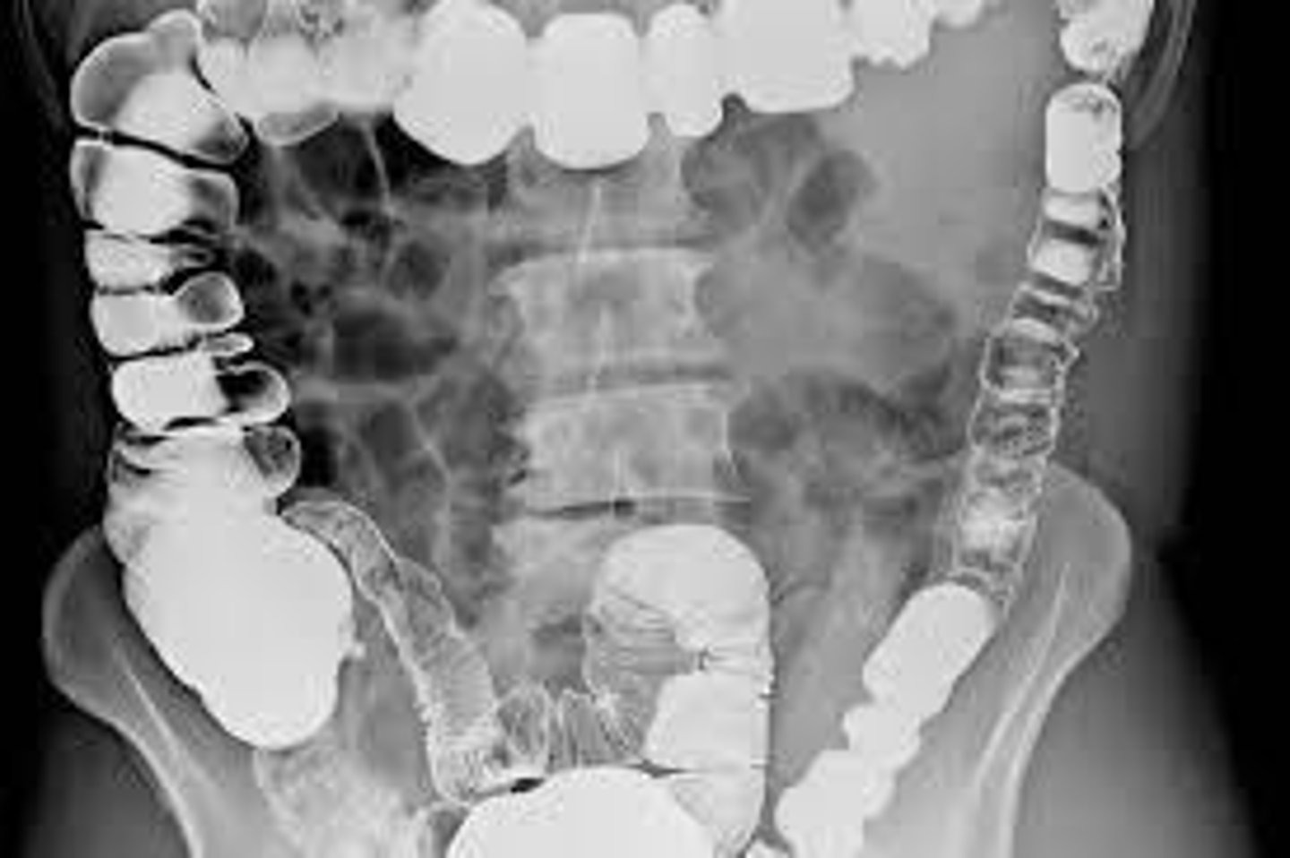 <p>A procedure for imaging the colon.</p>