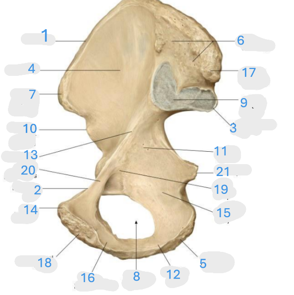 <p>Where is the superior pubic ramus</p>