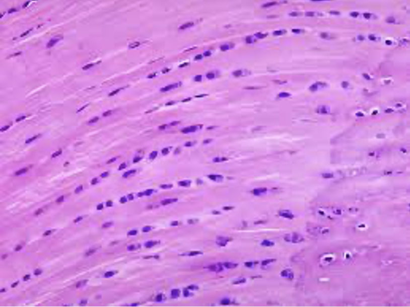 <ul><li><p>thick collagen fibres </p></li><li><p>not as densely packed like hyaline cartilage </p><ul><li><p>allows for compression </p></li></ul></li><li><p>provides cushioning for regions where the weight of body is being supported/ withstanding pressure </p></li><li><p>found: </p><ul><li><p>intervertebral discs in spinal column </p></li><li><p>meniscus of knee joint </p></li><li><p>tissues that join the 2 sides of the pelvis</p></li></ul></li></ul><p></p>