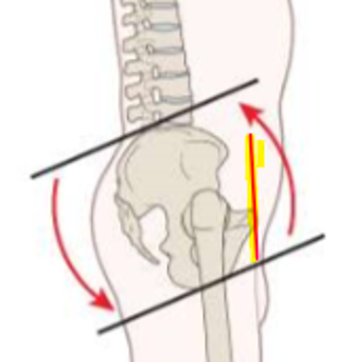 <p>force couple of hip extensors and trunk flexors</p><p>*ASIS is posterior to PS = hip extension</p>