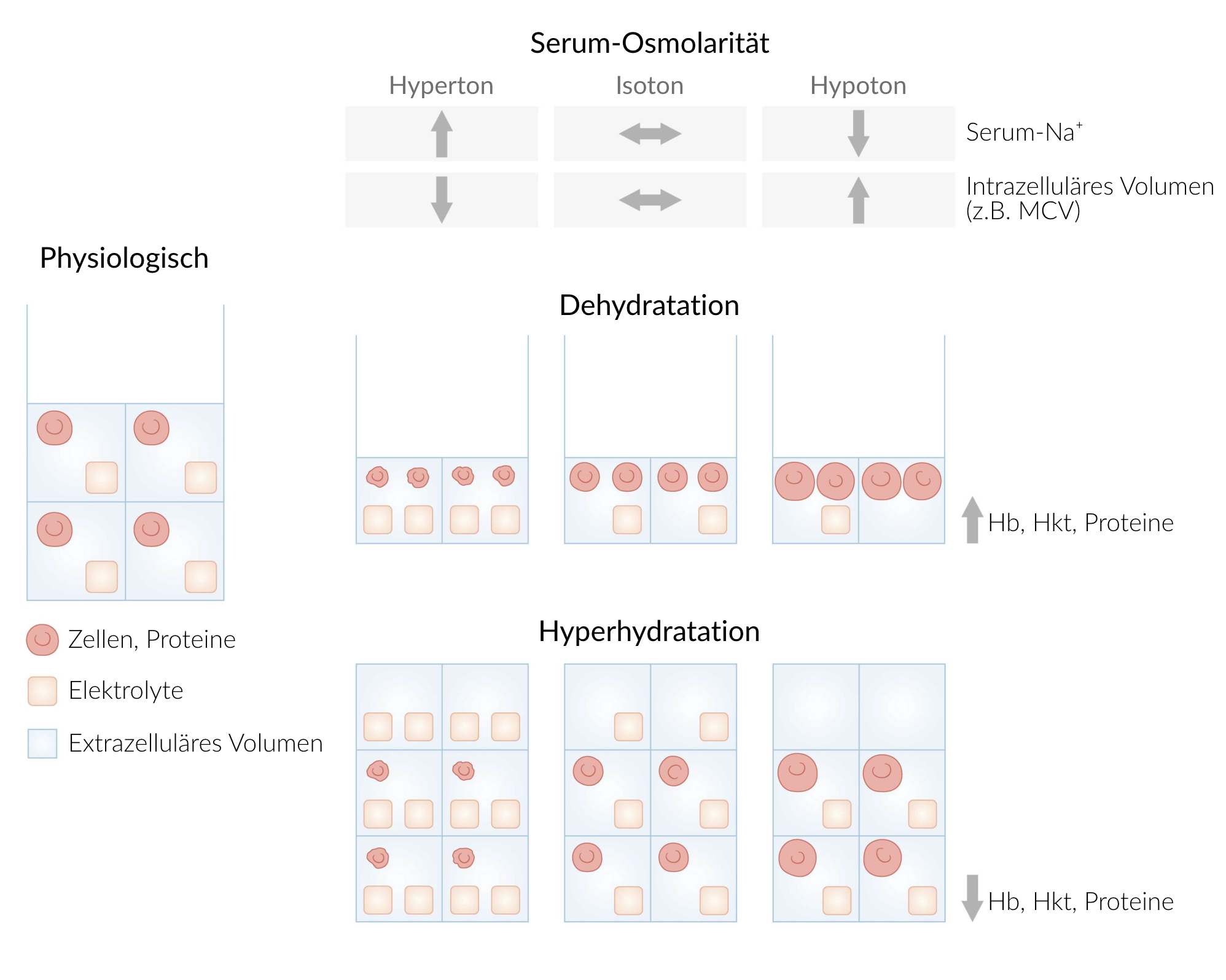 <p>B. Hypertonic dehydration</p>