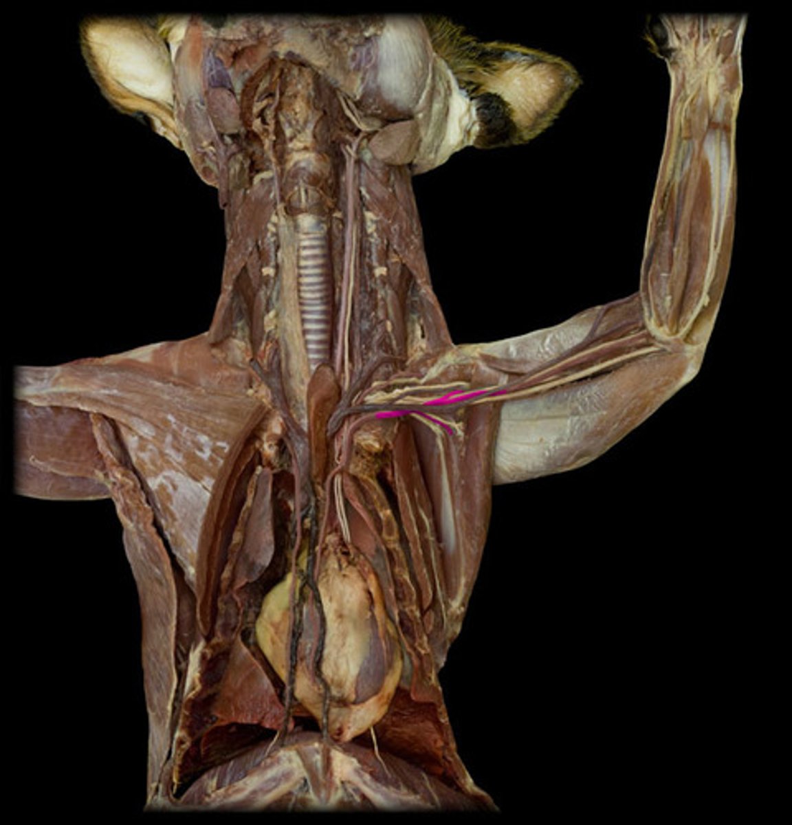 <p>name of the left subclavian after it passes the first rib</p>
