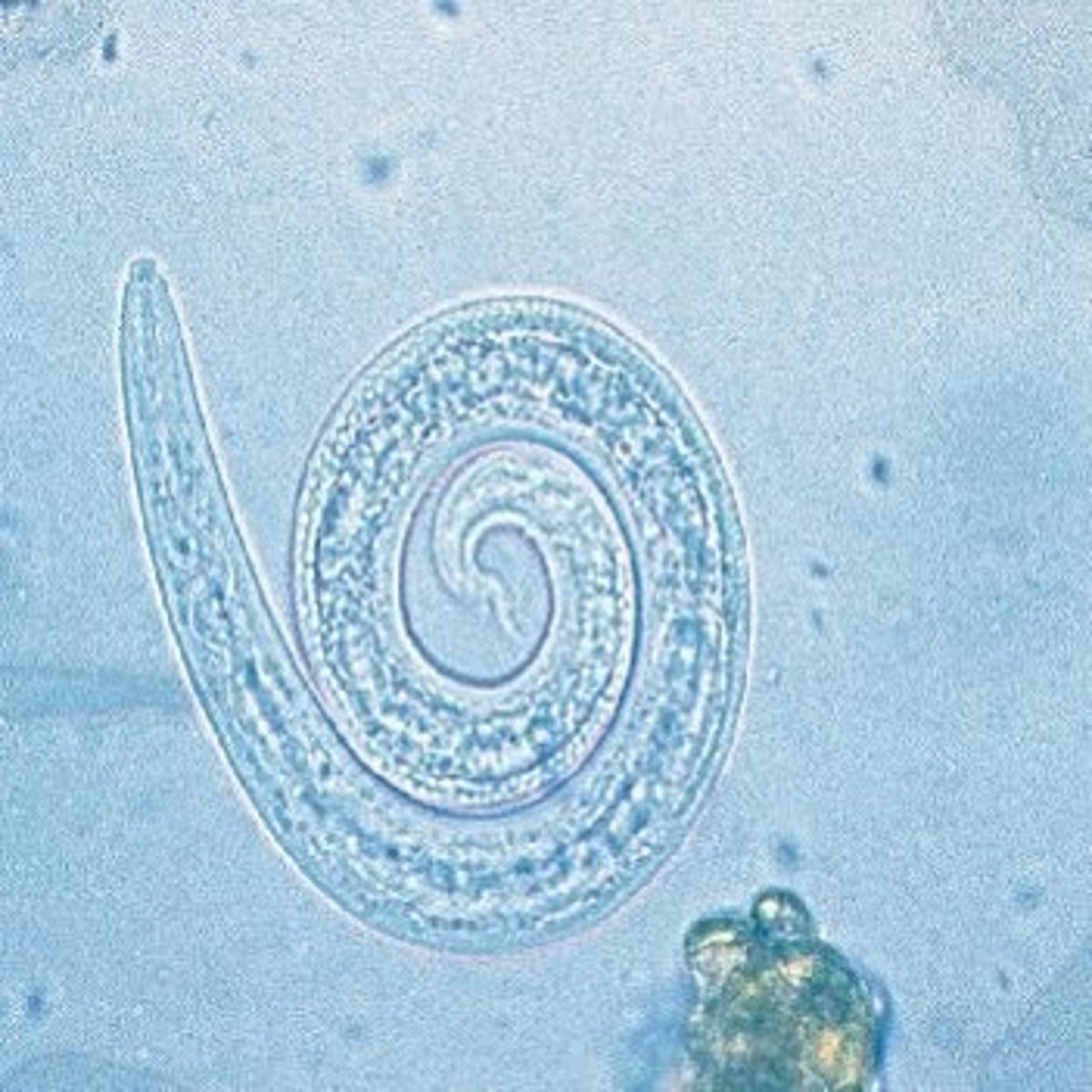 <p>This was found in a stool sample of a coughing cat. What is it?</p>
