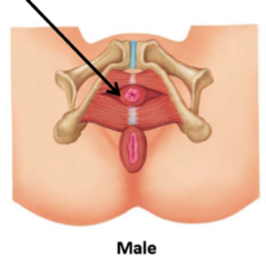 transverse perineal ligament; perineal pouch
