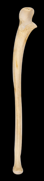 <p>What bone is this?</p><p>Left side or right side?</p><p>(Anterior view).</p>