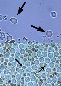 <p>What is in the urine sediment</p>
