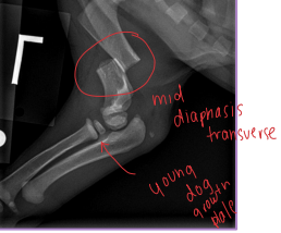 <ul><li><p><span style="background-color: transparent;"><strong><span>Forces: </span></strong><span>Tension, compression, bending, torsion, shear</span></span></p></li></ul><ul><li><p><span style="background-color: transparent;"><strong><span>Pattern: </span></strong><span>Transverse, Oblique, Spiral, Comminuted</span></span></p></li></ul><img src="https://knowt-user-attachments.s3.amazonaws.com/c7fcc65d-0ff7-44d7-8528-0cf5e77785b4.png" data-width="50%" data-align="center"><img src="https://knowt-user-attachments.s3.amazonaws.com/3f05b3fd-4873-4c6c-8b14-cc560e8a827e.png" data-width="50%" data-align="center"><p></p>