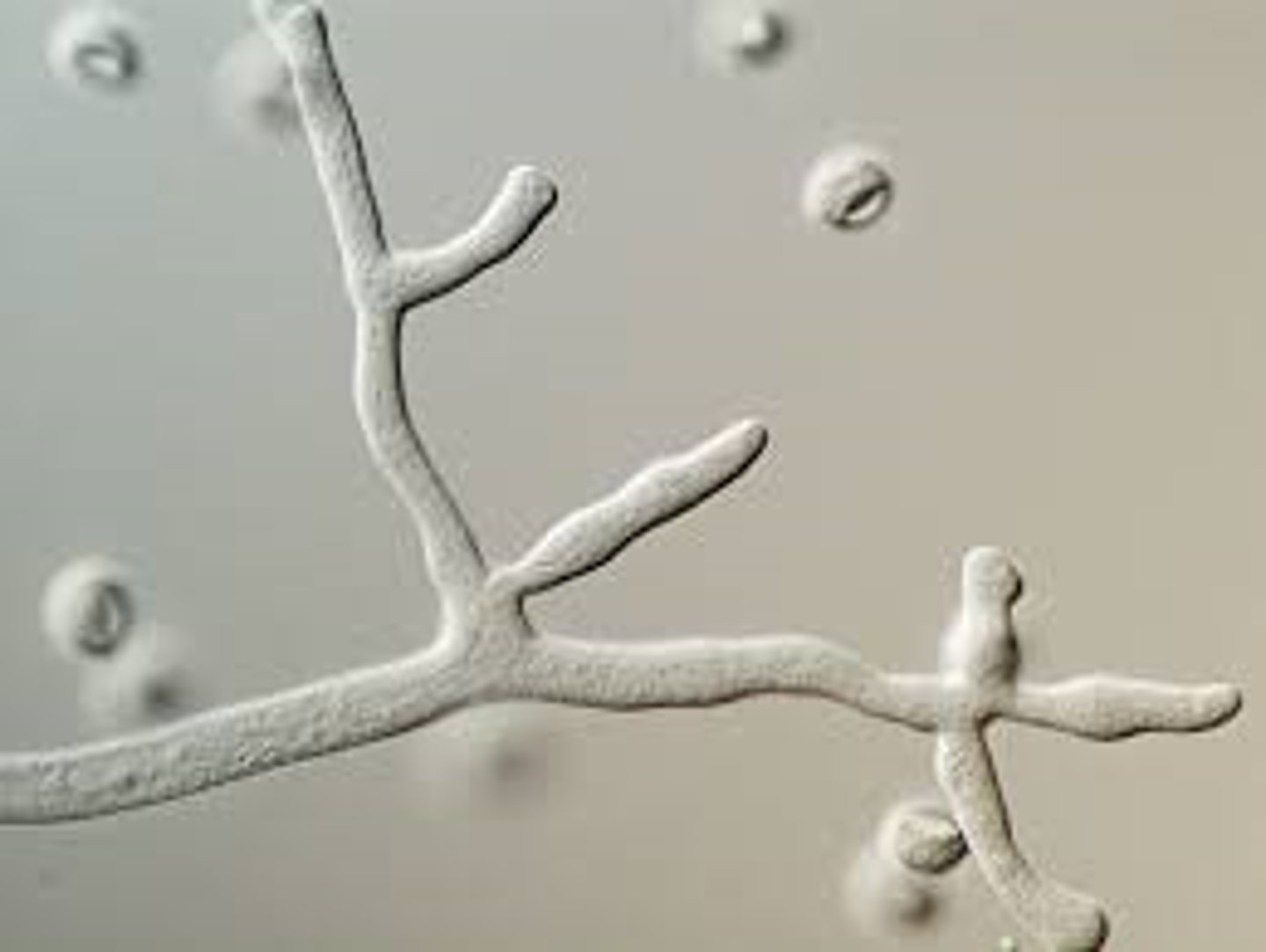 <p>Same:</p><p>- have a membrane and cell wall</p><p>Different:</p><p>- very long, tube-like structure</p><p>- nucleus divides repeatedly w/out any subsequent cell division (many nuclei)</p><p>Why?</p><p>Allows the cell to be long with a large surface area to absorb nutrients.</p>