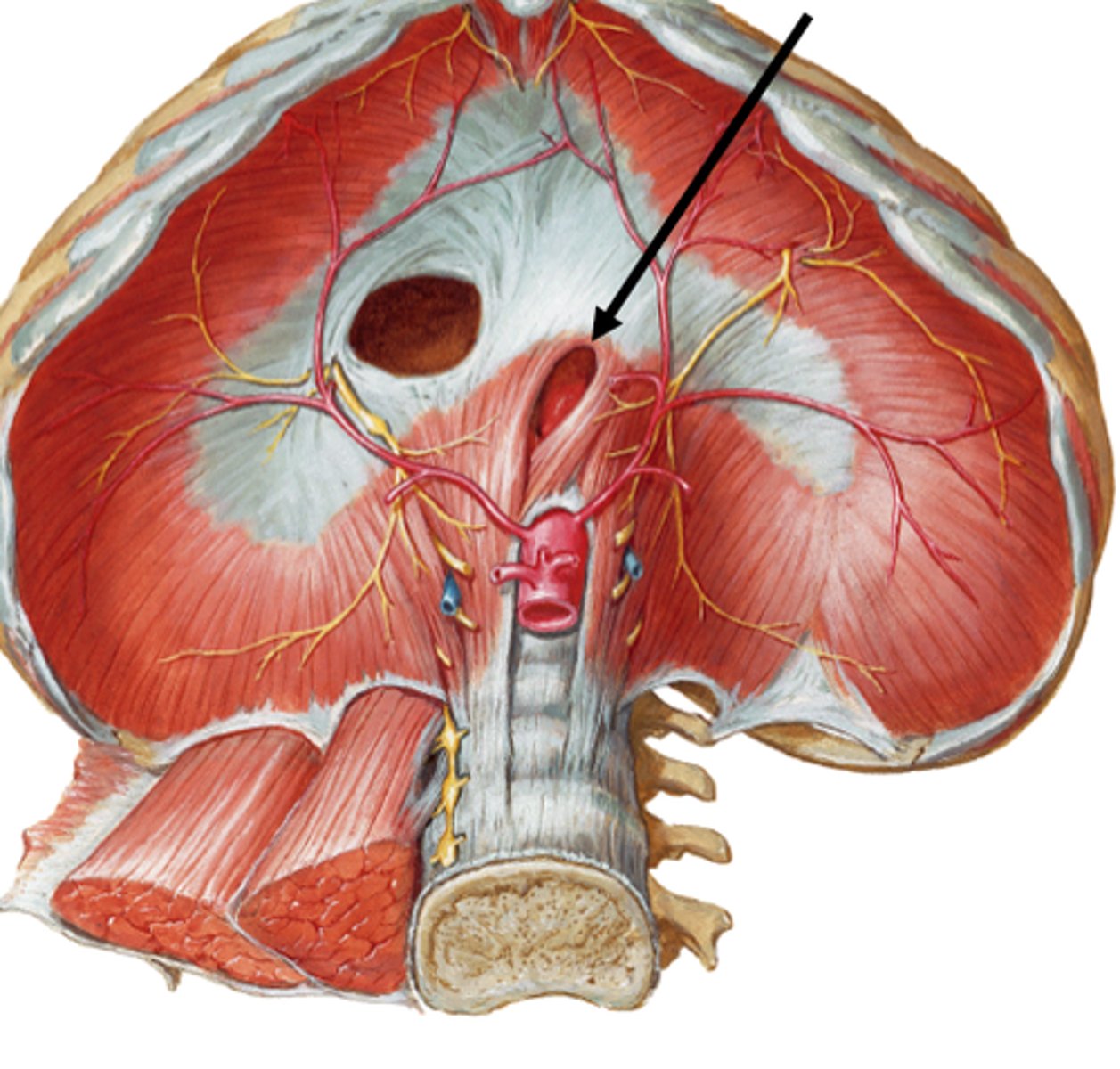 <p>opening in the diaphragm allowing the esophagus to pass through and enter abdomen</p>