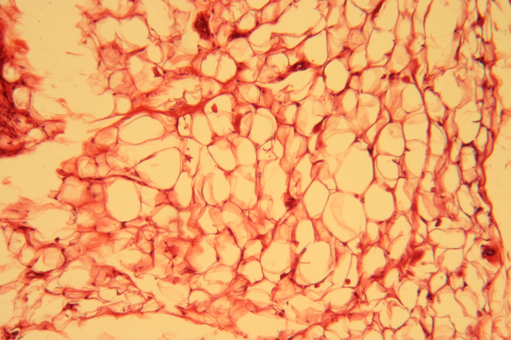 <p>Adipose Tissue — Location</p>