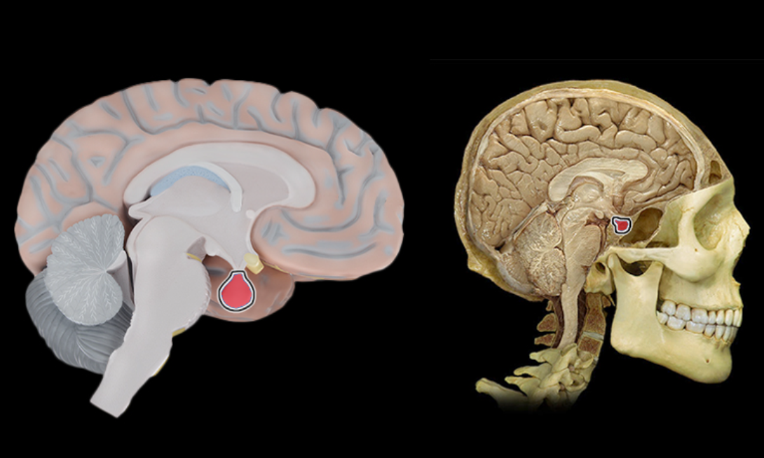 term image