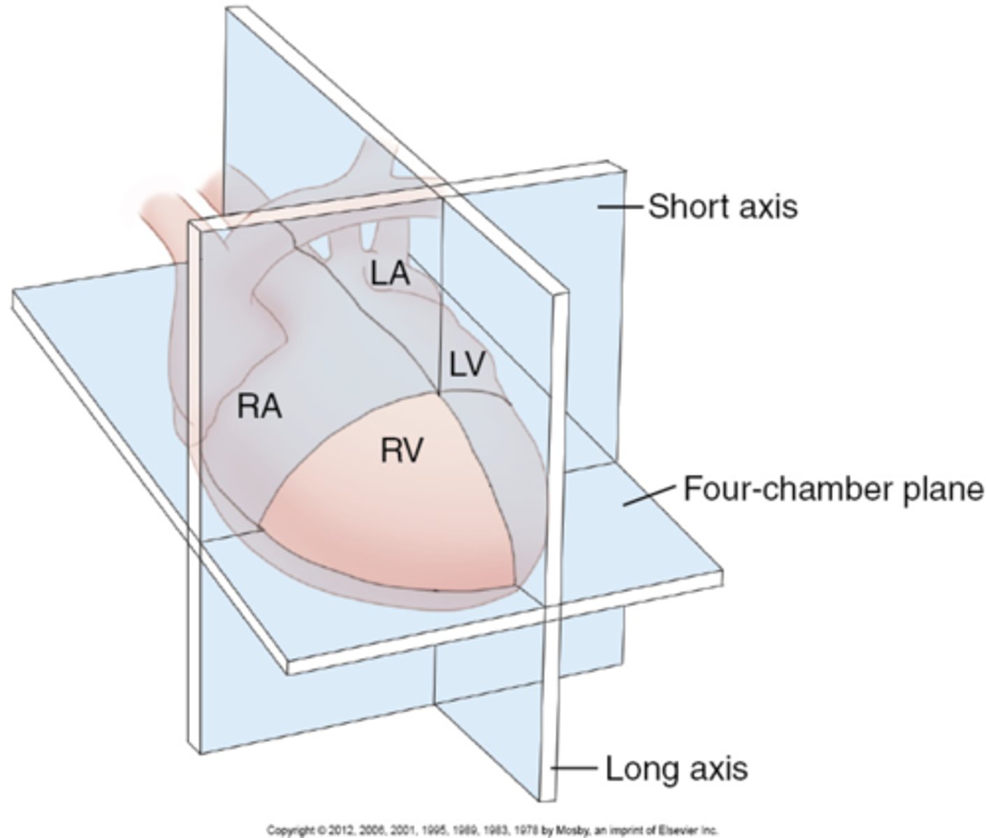 <p>1. long axis</p><p>2. short axis</p><p>3. 4CH</p>