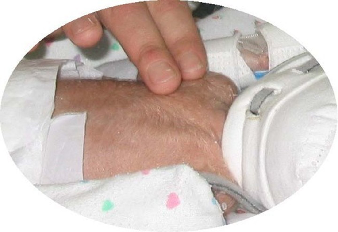 <p>Fine, soft DOWNY hair, especially that which covers the body and limbs of a very young infant or newborn.</p>