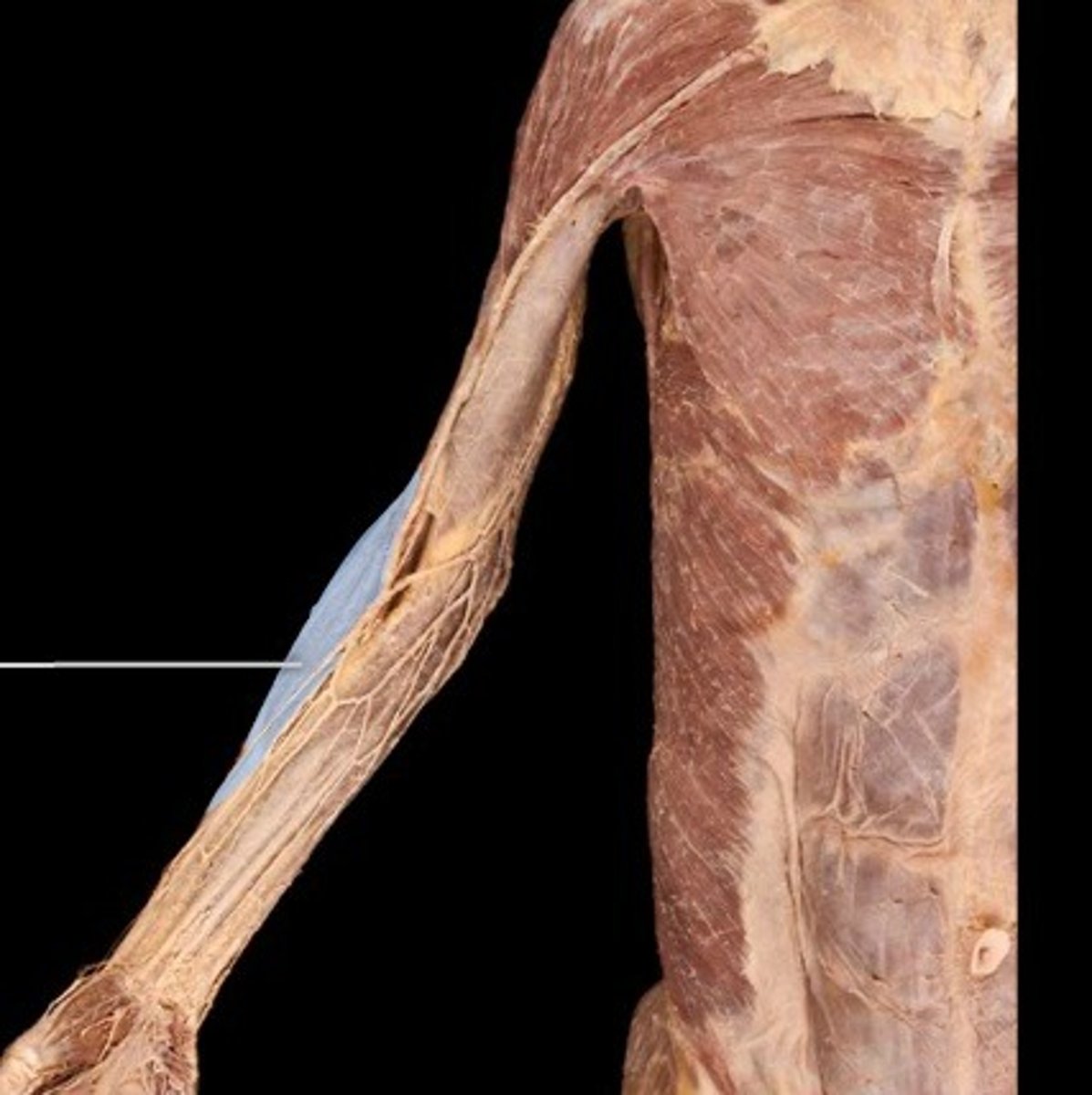 <p>What muscle is this?</p>