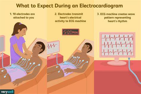 <p><span>What does the electrocardiogram represent?</span></p>