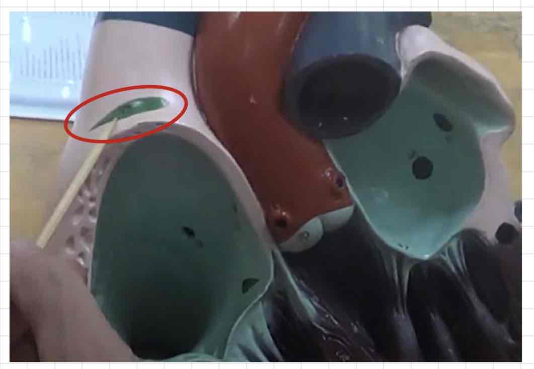 <p>what is this? (giant heart model)</p>