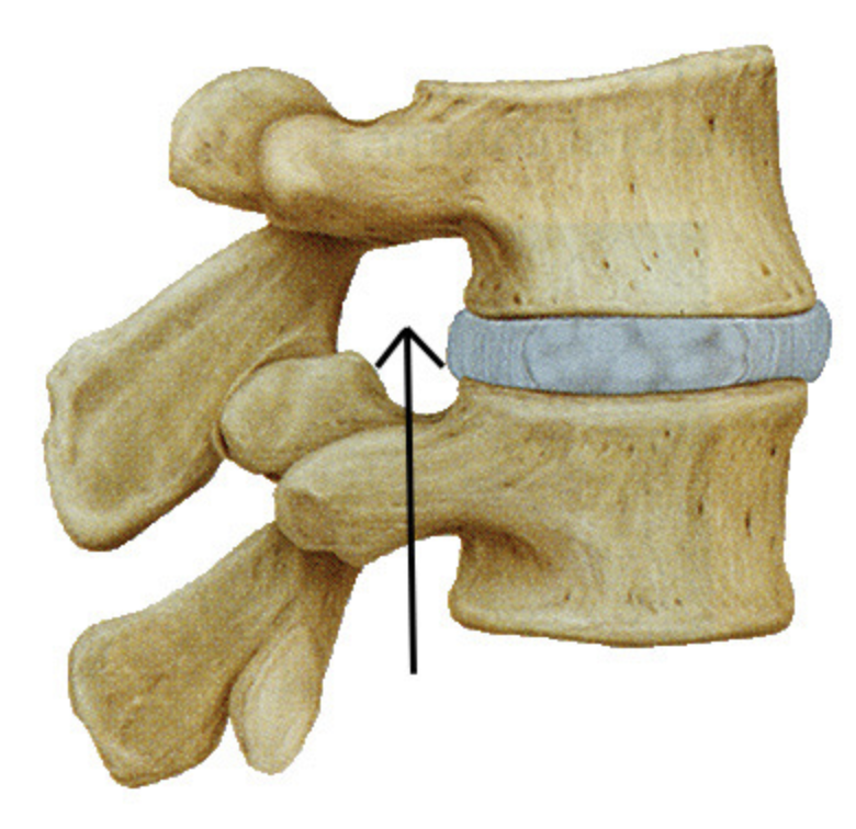 synovial: plane

inferior/superior articular facets of adjacent vertebrae