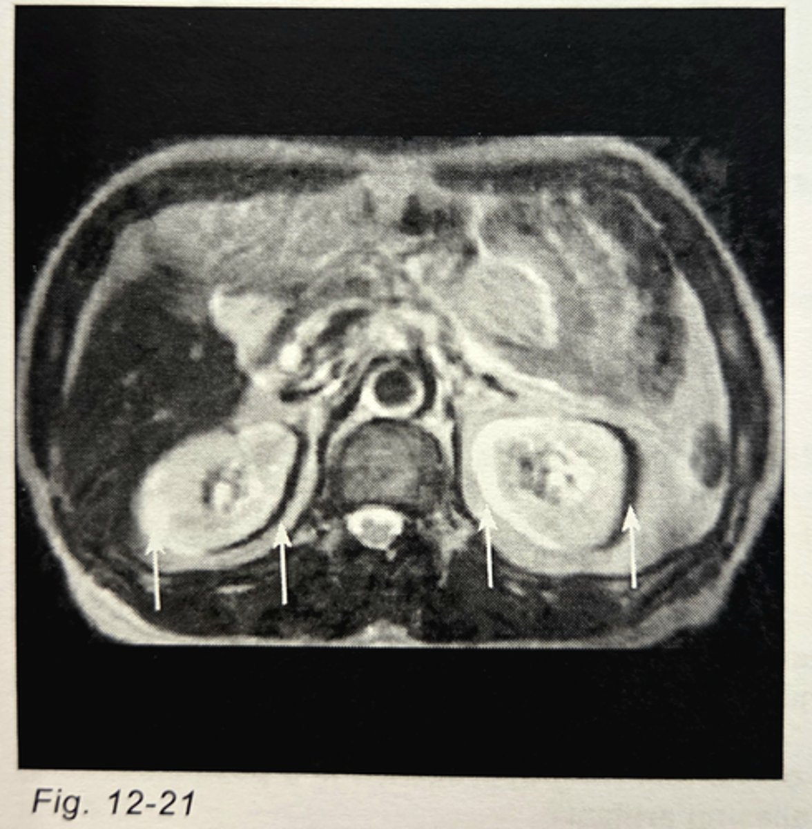 <p>y-gradient</p><p>3 multiple choice options</p>