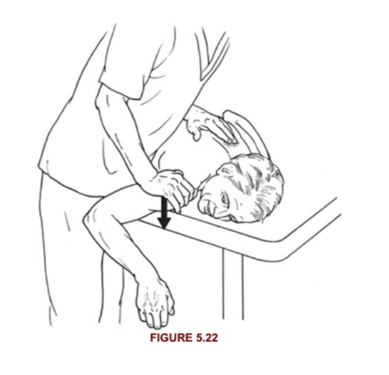 <p>5: Holds against max resistance</p><p>4: Holds against strong-moderate resistance</p>