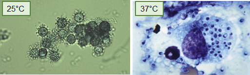 <p>A <strong>small, dimorphic yeast</strong> that survives <strong>intracellularly in pulmonary macrophages</strong>, where it can be <strong>seen inside macrophages</strong>.</p>