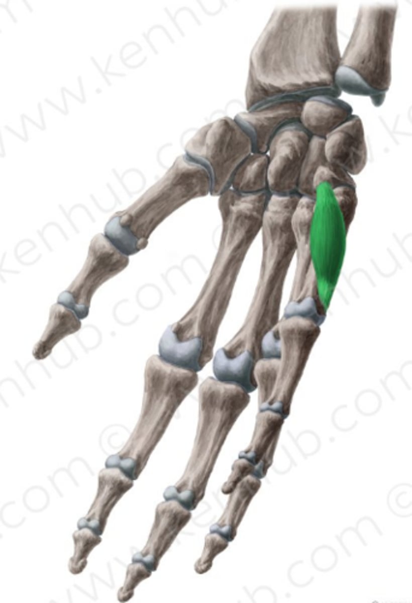 <p>Welke spier is dit?</p>