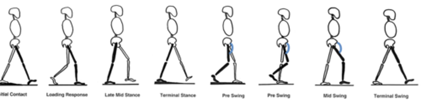 <p>Anterior thigh; rectus femoris, sartorius, iliopsoas</p><p>Lumbar nerve</p><p>-Weakness initiating swing phase with hip flexors (Light Blue)</p><p>-Compensate by circumducting the affected limb using hip abductors and adductors (Lean to contralateral side to create space for the limb to swing)</p>
