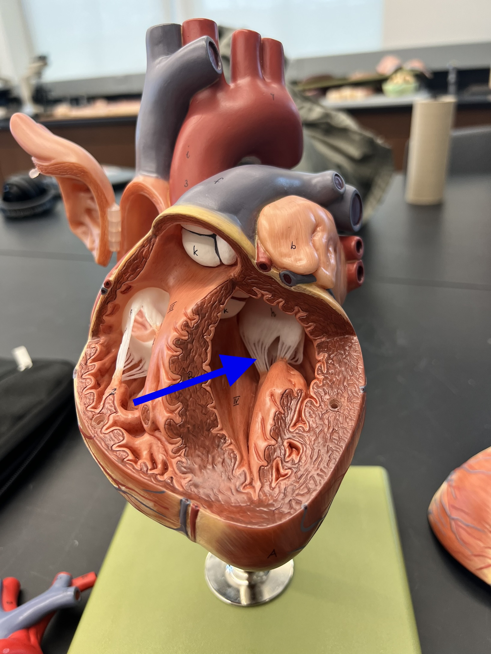 Name the heart structure.