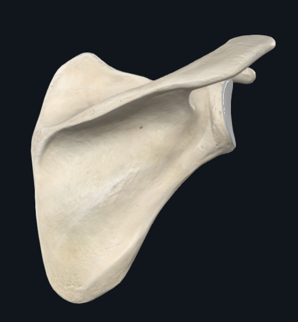 <p>What bone is this and what side?</p>