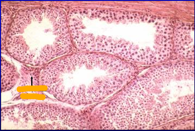 <p>Identify the cut:</p><p>Identify the structure:</p><p>Specie:</p><p>Orange:</p>
