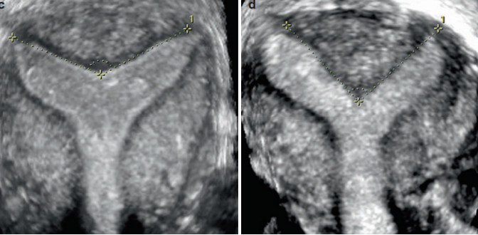 <p>which is arcuate and which is septate?</p>
