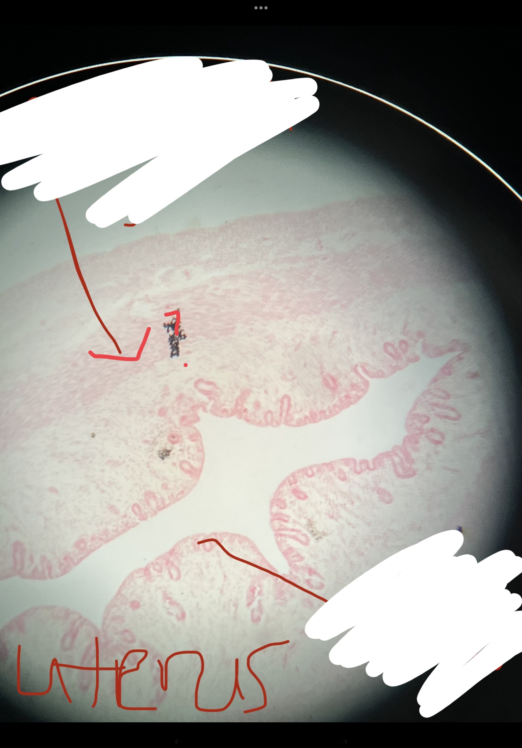 What is the arrow pointing to?