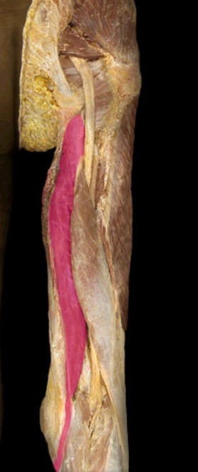 <p>next to biceps femoris, on top of membranosus, skinnier</p>