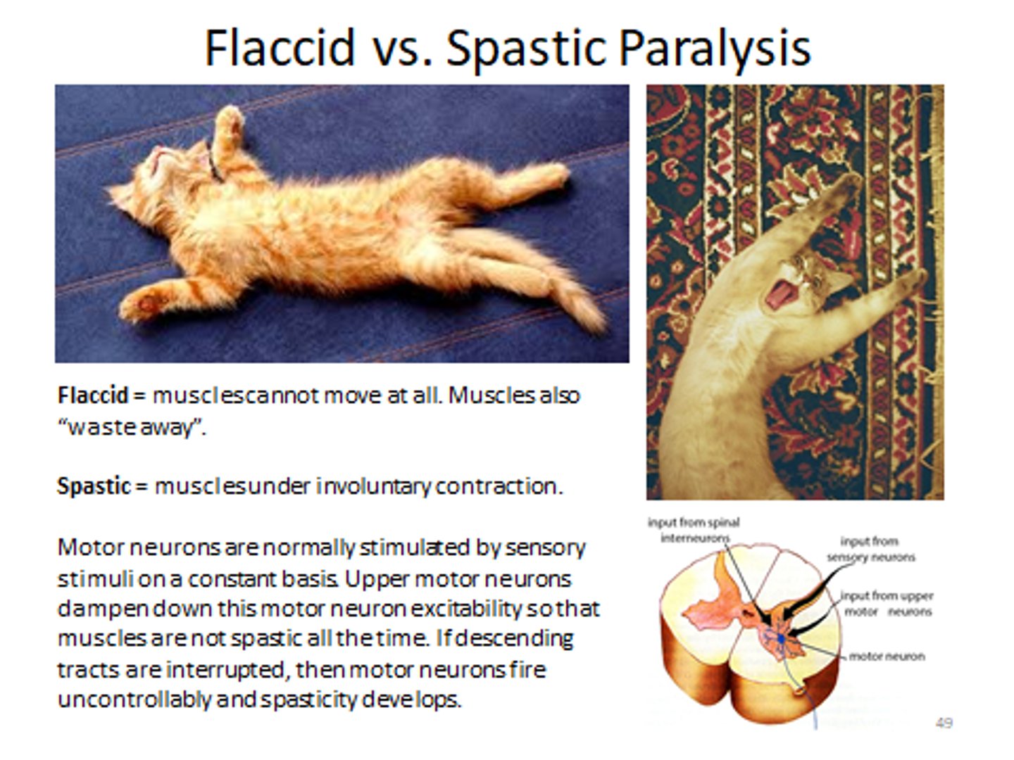 <p>function/movement DECREASES<br>- this is what actually carries out the movement so if this is damaged no movement will occur --&gt; atrophy of muscles since they are not being used<br>- flaccid paralysis, muscle atrophy, decreased reflexes</p>
