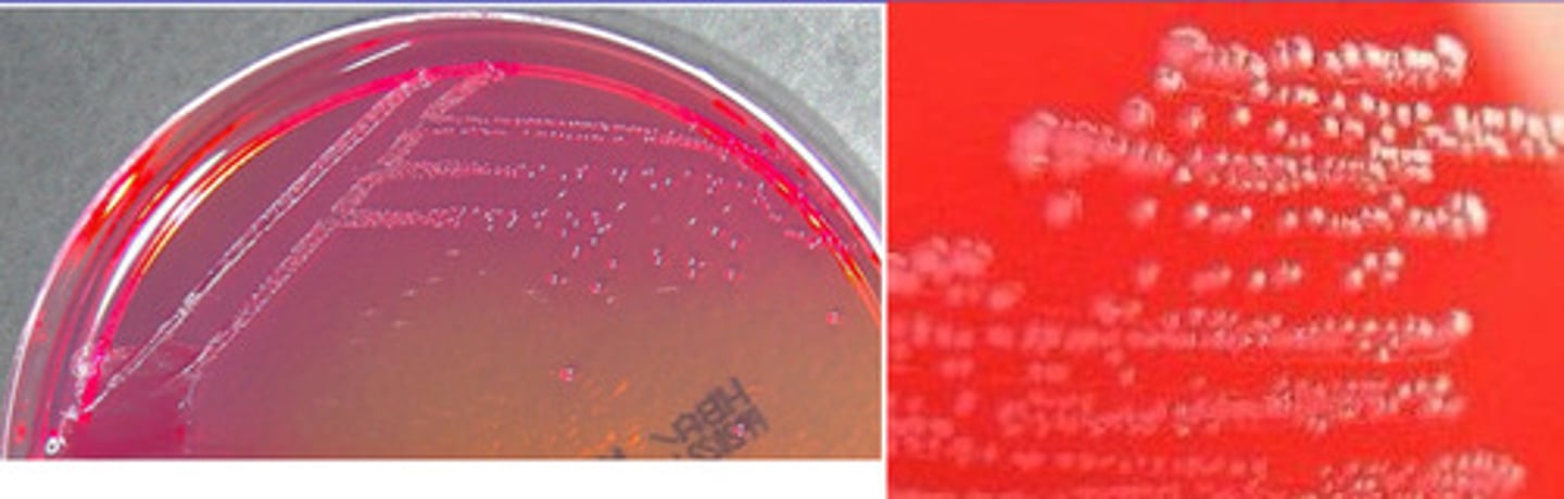 <p>GPC, catalase neg</p>